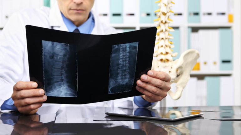 Arzt überprüft Röntgenbilder der Wirbelsäule
