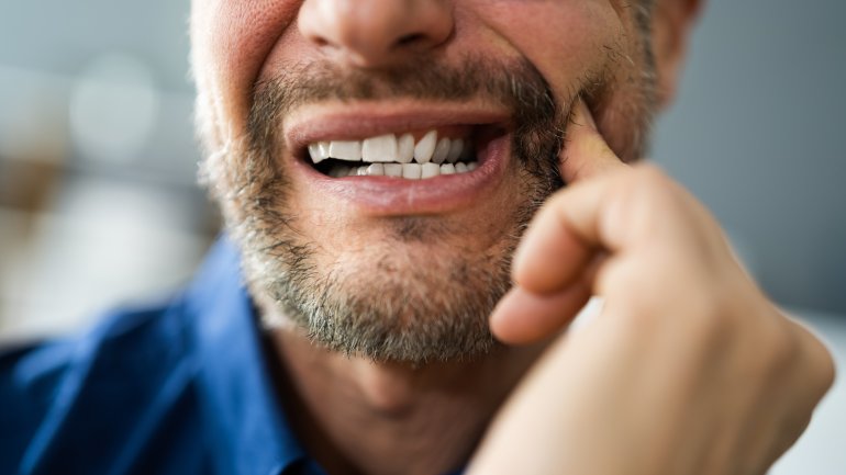 Mann mit Zahnschmerzen hält sich schmerzenden Backen