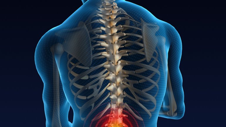 Bei Rückenschmerzen muss geröntgt werden.